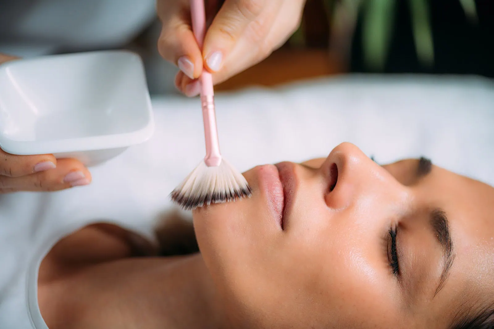Chemical Peels Hover